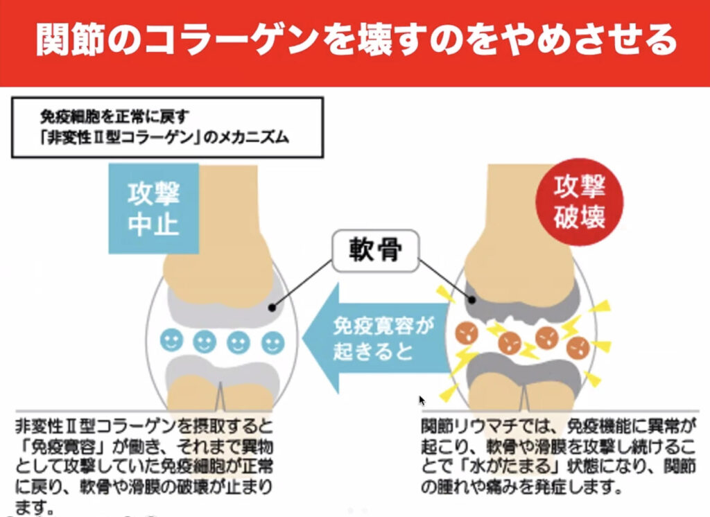 コラーゲンucは関節のコラーゲンを壊すのをやめさせる説明画像
