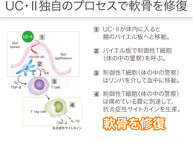 軟骨修復解説写真